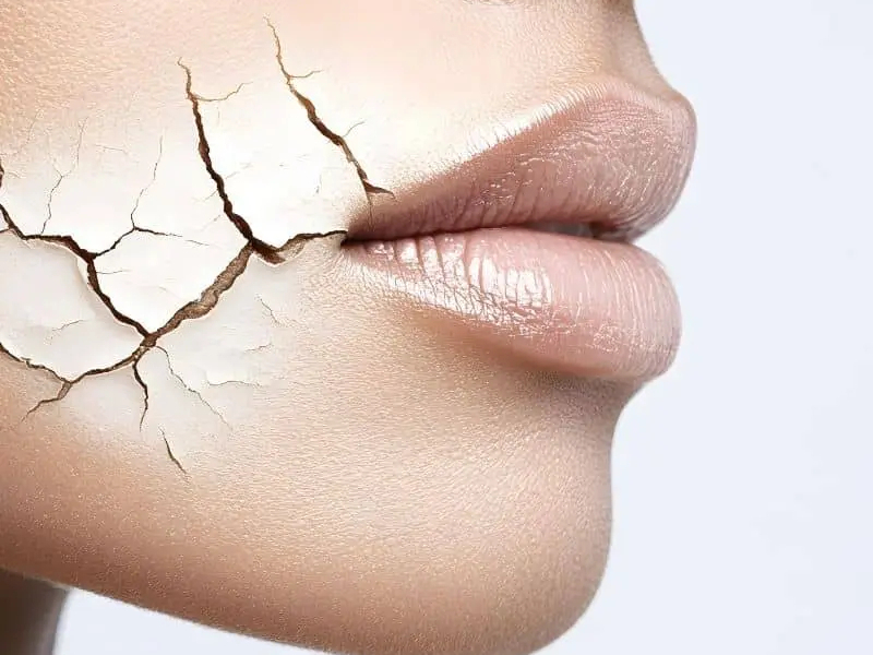 Comment le lait d'ânesse revitalise les peaux les plus sèches